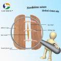 Medizinischer Wundverschluss Verbrauchbar mit ISO13485